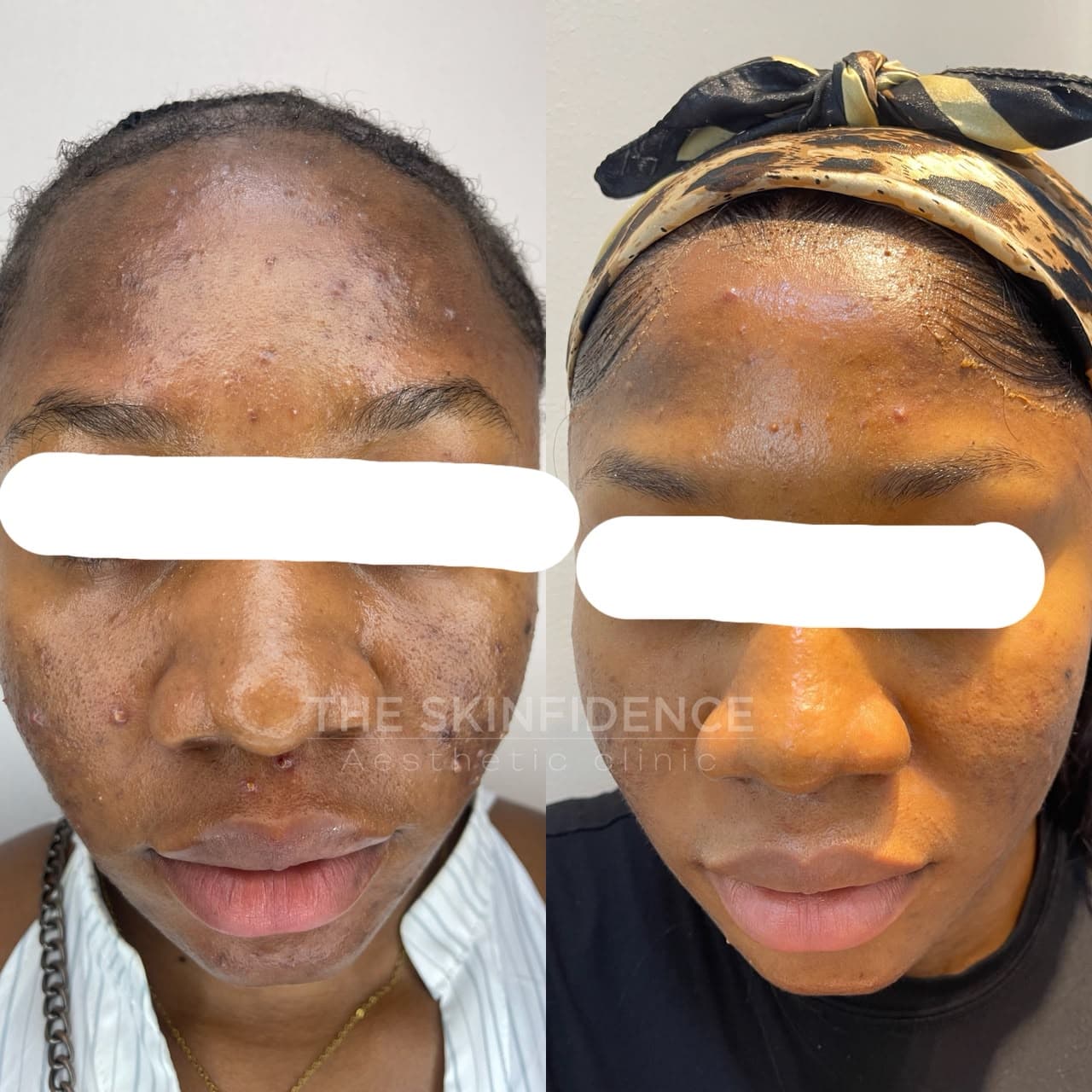 Medical-Grade Facial