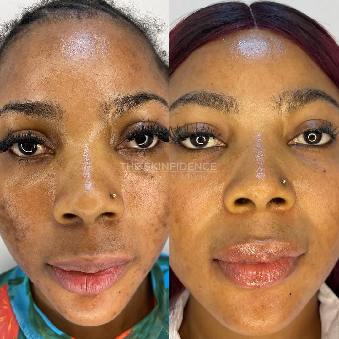 [ 03 · TONE & CLARITY · BEFORE / AFTER ]